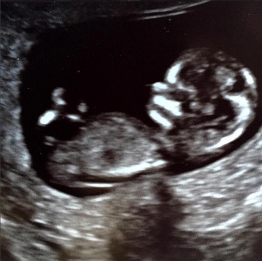Die freudigen Babynews verkündete der ehemalige