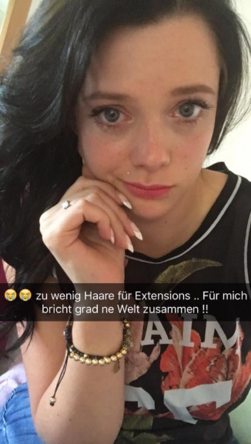 Die 24-Jährige leidet unter starkem Haarausfall.