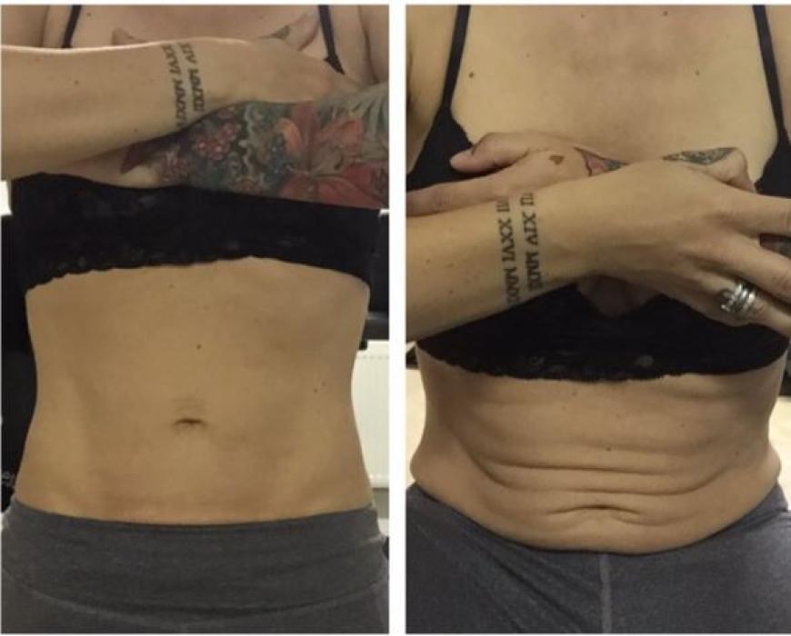 Dieses After-Baby-Body-Foto ist der Grund für die negativen Kommentare.