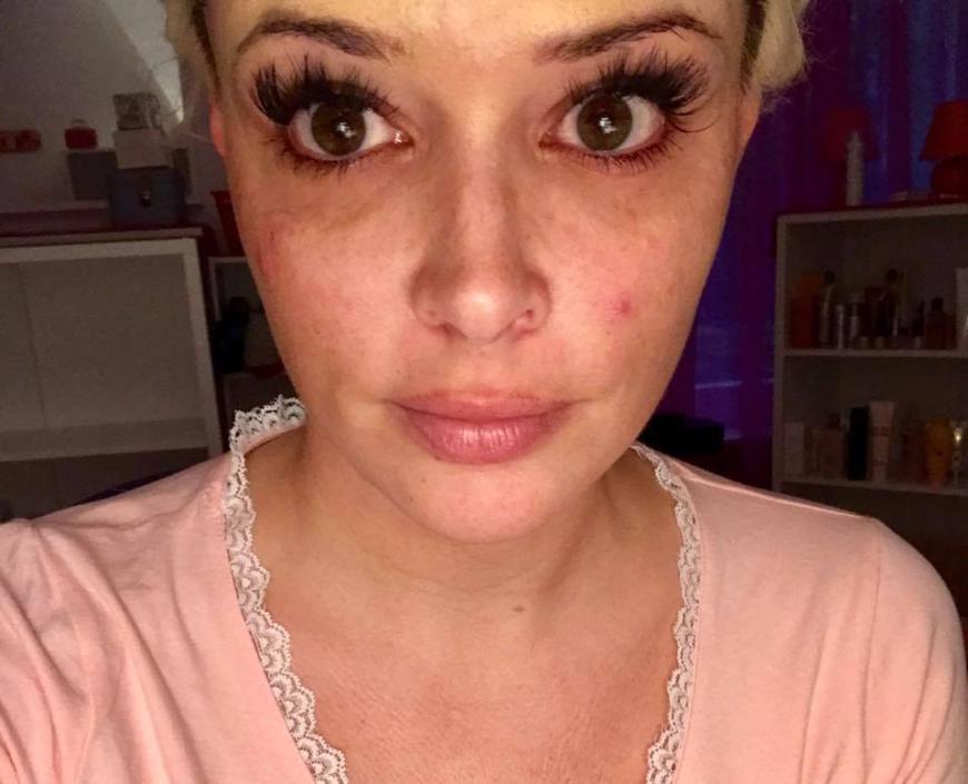 Pickelchen, na und? Daniela Katzenberger zeigt ihren Fans, wie sie ohne Make-up aussieht ...
