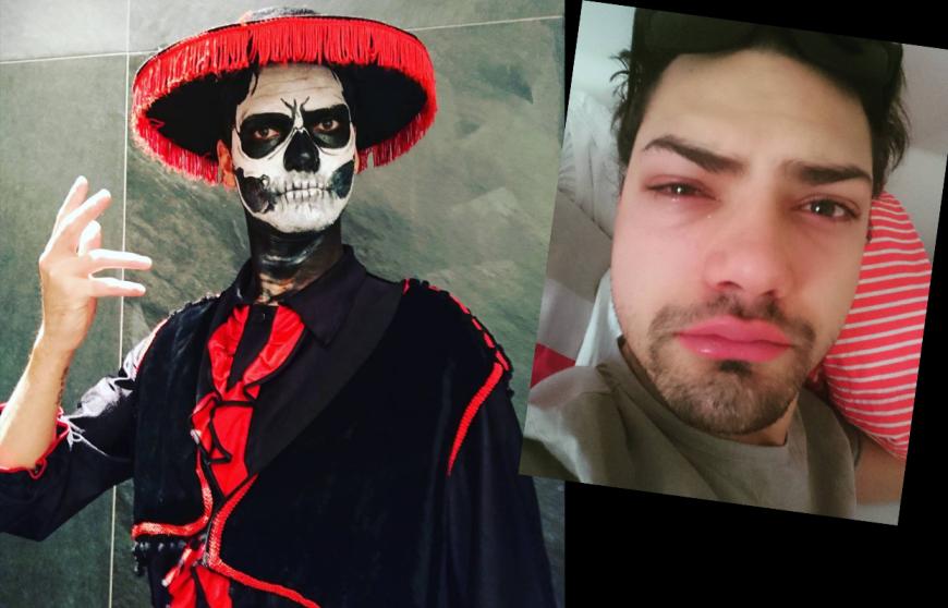 Jimi Blue Ochsenknecht erlitt am Halloween-Wochenende einen unschönen Schock.