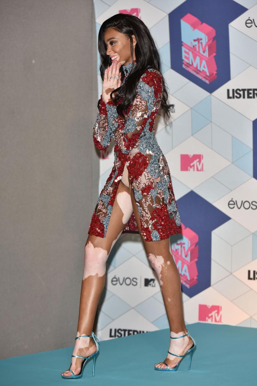 Model Winnie Harlow zeigte einen gewollten Höschenblitzer.