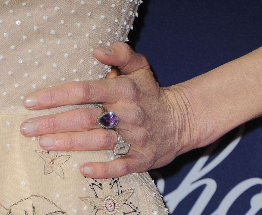 Leider hat Nicole Kidman nicht nur ihr Gesicht nicht mehr im Griff, auch ihre Nägel sind dreckig. Wir gehen nicht davon aus, dass Nicole kurz vor der Verleihung noch Gartenarbeit betrieben hat...