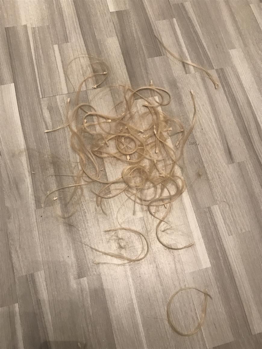 Und nach 6 Monaten sollten, unserer Empfehlung nach, die Bondings entfernt werden.