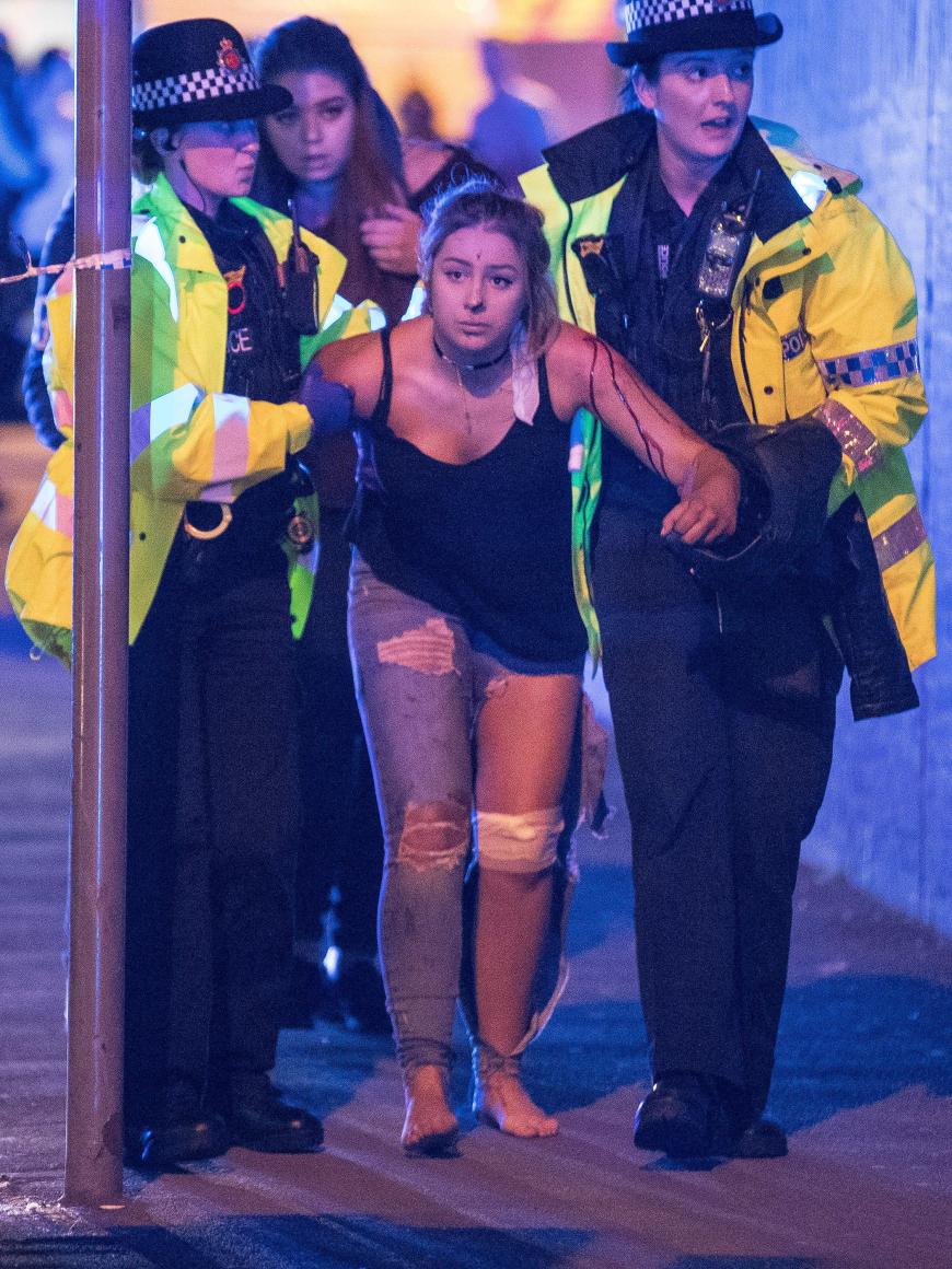 Der Schock ist ihr ins Gesicht geschrieben. Blut läuft dieser Konzertbesucherin über den Arm, als sie von Polizeibeamten aus der