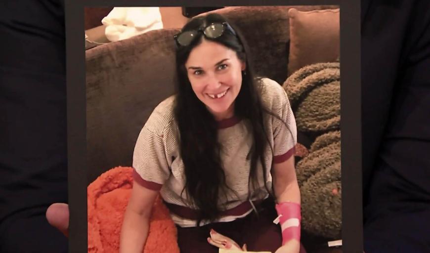 Krasser Anblick: Demi Moore ohne Zähne
