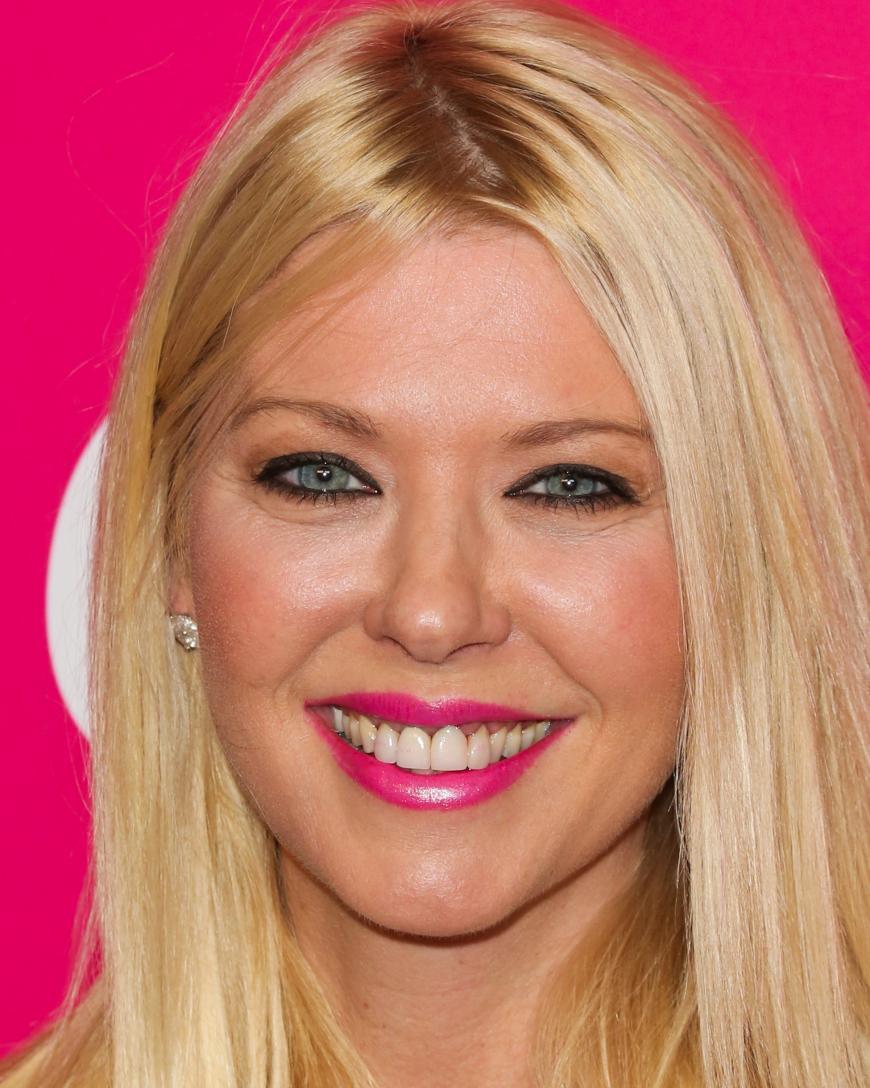 Auch die Zähne der Schauspielerin sind deutlich überkront oder mit Veneers versehen, doch der Randschluss ist nicht mehr gegeben. Tara Reid wirkt 2016 zunehmend ungepflegter.