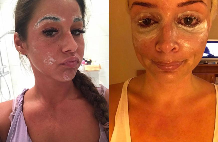 Obwohl Sarah Lombardi die Creme auf die Augenbrauen schmiert und nicht auf die Augenpartie, fällt den Usern doch die Ähnlichkeit der Postings auf. Die Katze teilte das Bild am 16. Juli auf Facebook, Sarah am 25. Juli.