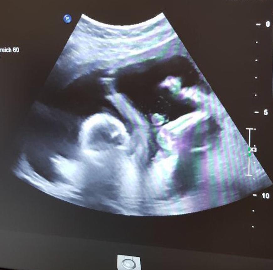 "Fopsi", das Baby von Samantha Abdul und Oleg Justus, hat scheinbar null Bock auf diesen Spitznamen!
