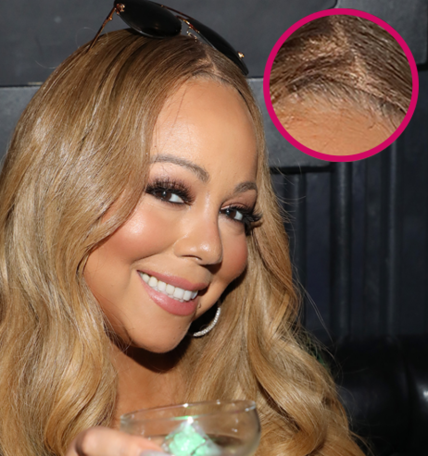 Hie nochmal die Nahaufnahme der Perücken-Panne von Mariah Carey.