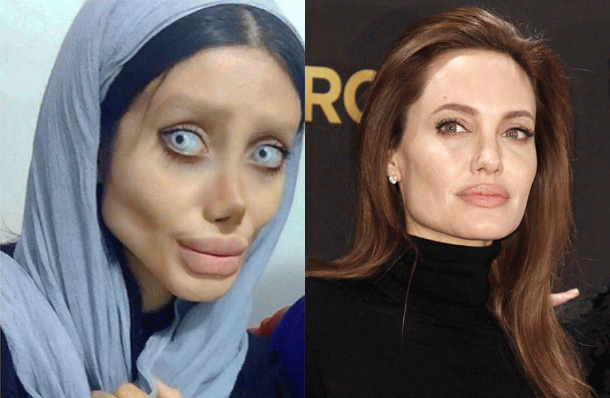 Sahar Tabar wollte aussehen wie Angelina Jolie. Dafür geriet sie in die Magersucht und ließ sich über 50 Mal operieren.