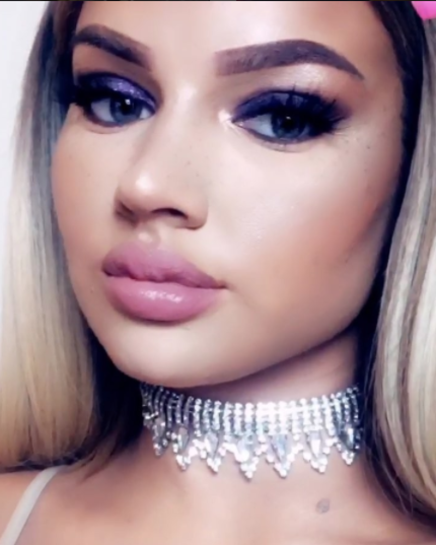 Shirin David leugnet Beauty-Op Eingriffe an ihrer Lippe...