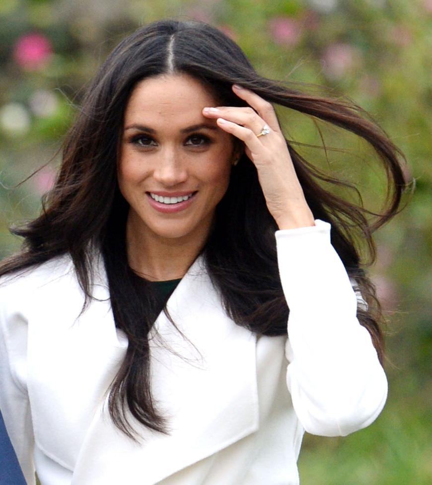 Meghan Markle ist wunderschön, doch hat sie ein kleines bisschen nachgeholfen?