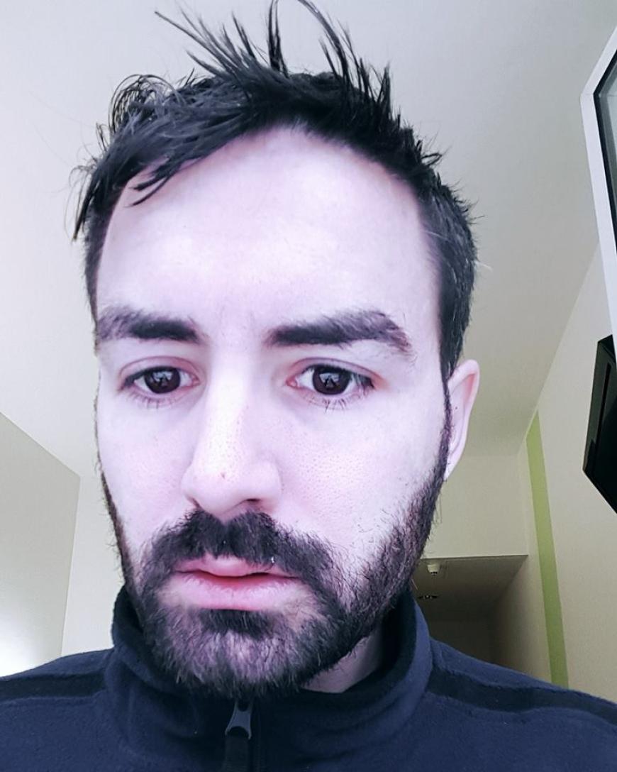 Menderes Bağcı geht es derzeit alles andere als gut. Nach seiner Not-OP vergangener Woche, meldet sich der Entertainer mit diesem Schock-Foto an seine Fans.