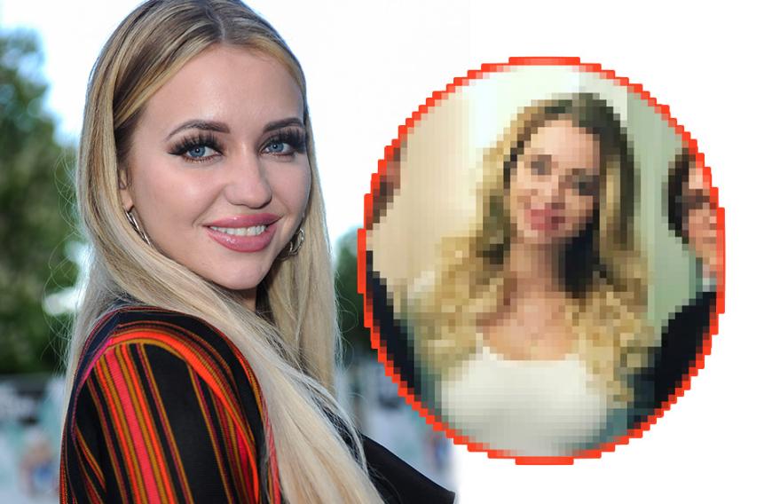 Bye, bye Knolle - hallo Stupsnase! Das dachte sich Cathy Lugner vor ihrem letzten Beauty-Eingriff. Leider ging der Schuss nach hinten los.