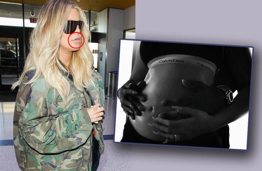 Auch wenn Khloé Kardashian schwanger ist, möchte die 33-Jährige auf den Gang zum Beauty-Doc nicht verzichten. Ob sie damit ihrem Baby schadet, ist der werdenden Mutter offenbar egal.