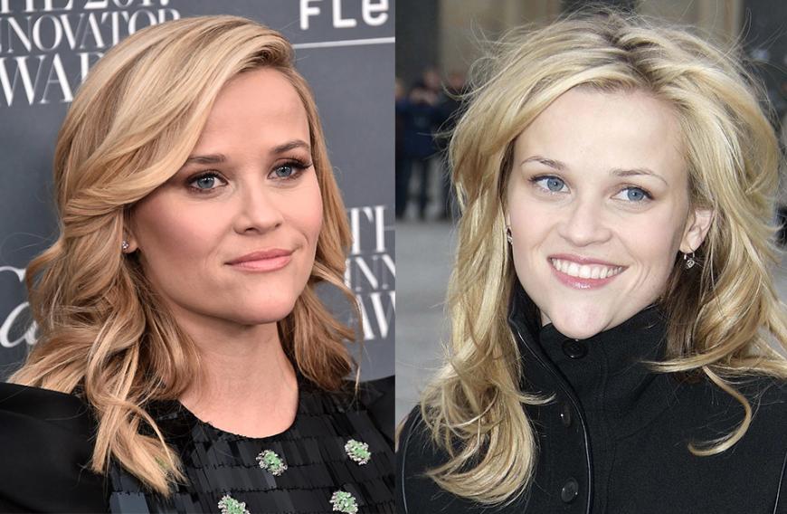 Reese Witherspoon damals und heute – im rechten Bild war das Kinn noch deutlich länger und hervorstehender.