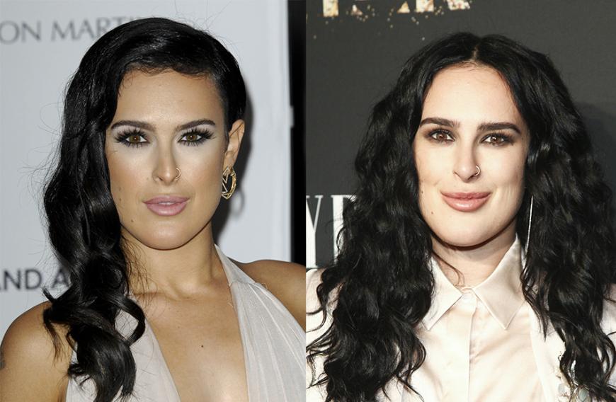 Rumer Willis: Lange Zeit war ihr breites Kinn schon fast eine Art Markenzeichen. Doch im linken Bild wirkt es um einiges spitzer und dezenter.