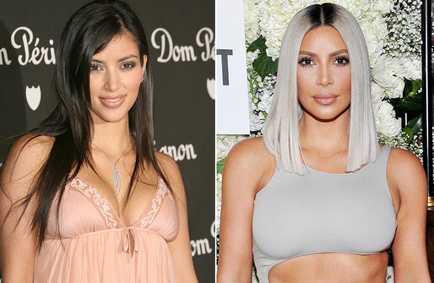 Kim Kardashian ist das Aushängeschild der Familie - und das nicht zuletzt aufgrund ihrer krassen Beauty-Transformation der letzten Jahr. Po, Busen, Nase, Lippen, Botox - alles hat die 37-Jährige machen lassen. Man kann von den Kardashians sicher halten, was man will, aber der Vorher-Nachher-Vergleich zum Jahr 1996 zeigt, dass den KUWTK-Stars in Sachen Beauty-OPs keiner etwas vormacht. Mit fast 40 Jahren sieht Kim besser aus denn je!