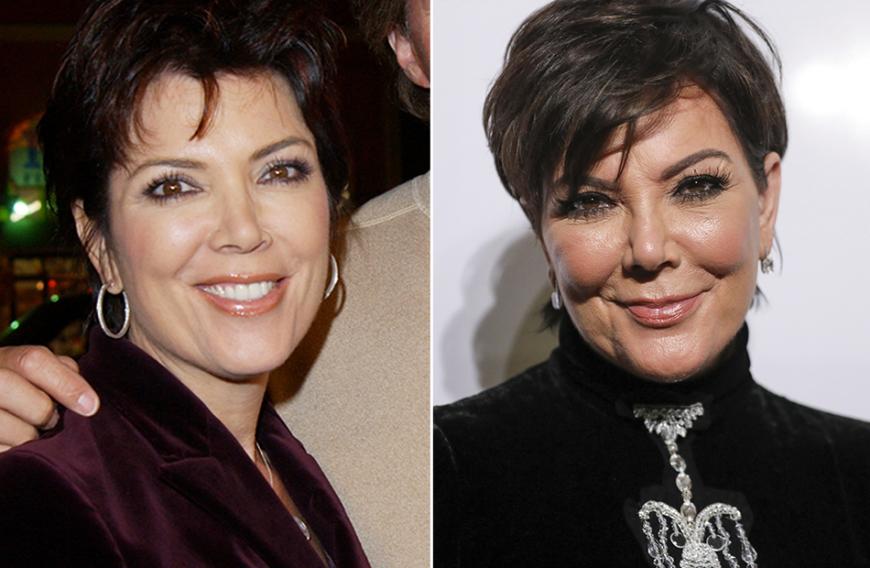 Natürlich fällt der Apfel nicht weit vom Stamm: Mama Kris Jenner ist für ihre Beauty-OPs bekannt. Ein Vergleich zum Jahr 2004 zeigt allerdings, dass sich der Alterungsprozess auch bei der 62-Jährigen auf Dauer nicht aufhalten lässt ...