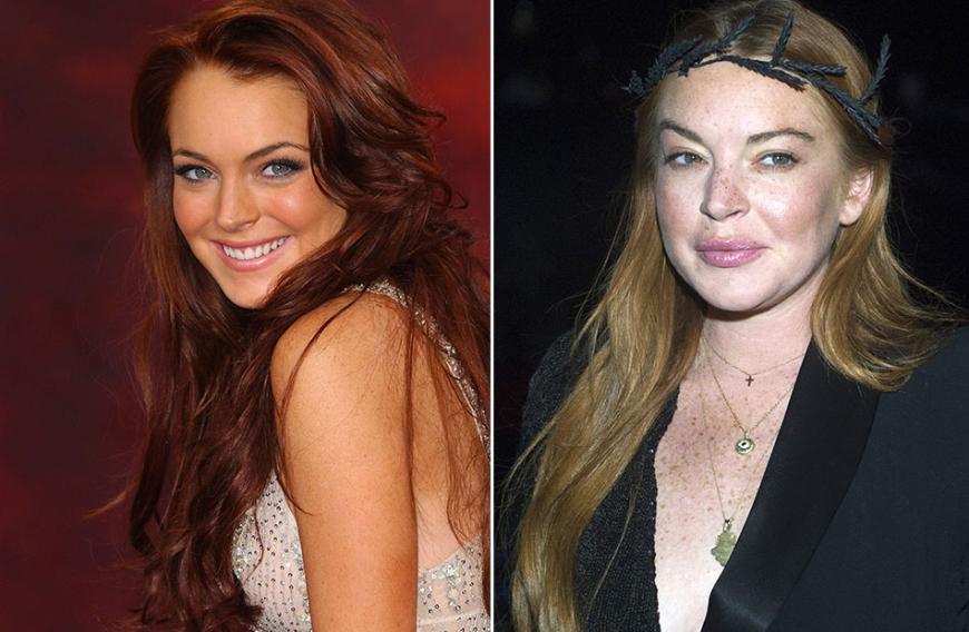 Die krassesten Beauty-Transformationen der Stars ...