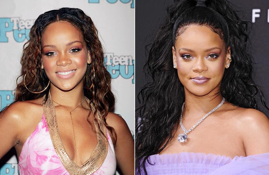 Außer einer leichten Nasen-Korrektur hat Rihanna zum Glück nichts machen lassen - und das ist auch gut so! Schon 2005 als ihre Karriere gerade begann sah die Sängerin umwerfend aus. 2018 gilt sie weltweit als eine der führenden Stil-Ikonen.
