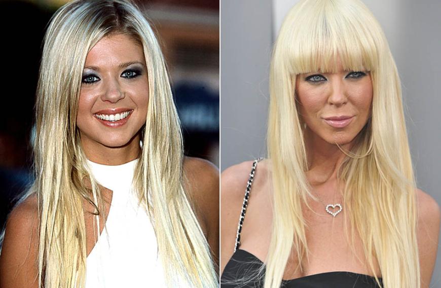 Noch ein perfektes Beispiel für: SO bitte nicht! Aus der süßen Tara Reid, 42, aus dem Jahr 2001, ist eine Frau geworden, die sicherlich niemand mehr als schön bezeichnen würde. Beauty-OPs bringen eben nicht immer den gewünschten Erfolg.