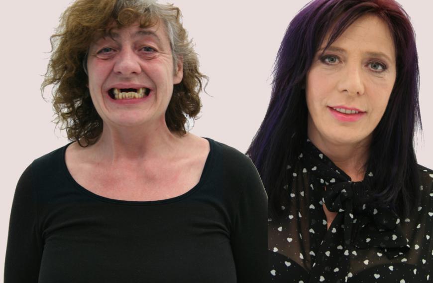 Kaum zu glauben, dass das dieselbe Frau ist! Vorher hatte Grit struppiges Haar und fehlende Zähne. Nachher: Die Haare sind gemacht, die Zähne neu - die Berlinerin kann wieder lächeln.