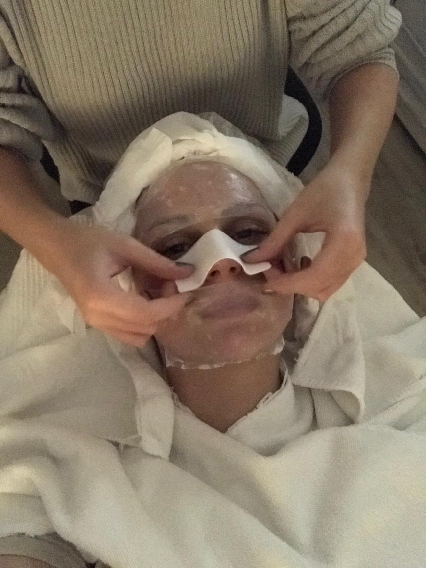 Hier wird nach der Microdermabrasion die Hydrolage aufgetragen, für die extra Portion Feuchtigkeit.