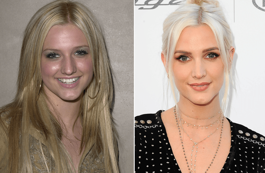 Schnipp, schnapp - auch Ashlee Simpson hat beim Beauty-Doc nachhelfen lassen.