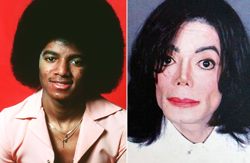 Michael Jackson ist nach wie ... | Die Nasen-OPs der Stars ...