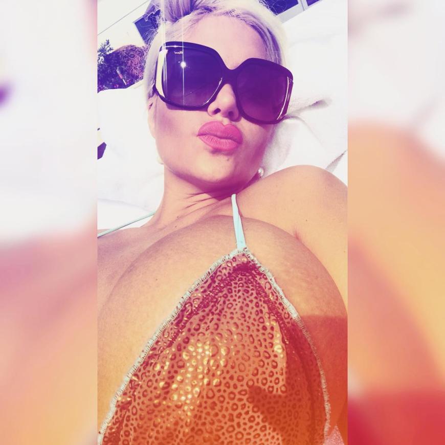 Sophia Wollersheim hat sich erneut einer Beauty-OP unterzogen.