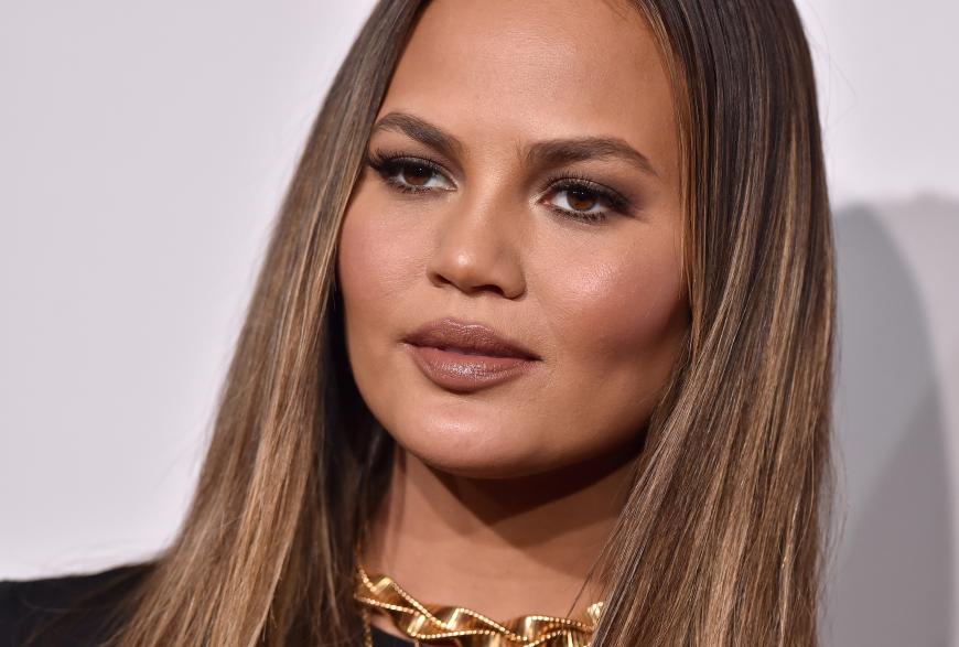 Chrissy Teigen hat mit ihrer zweiten Schwangerschaft zu kämpfen. 