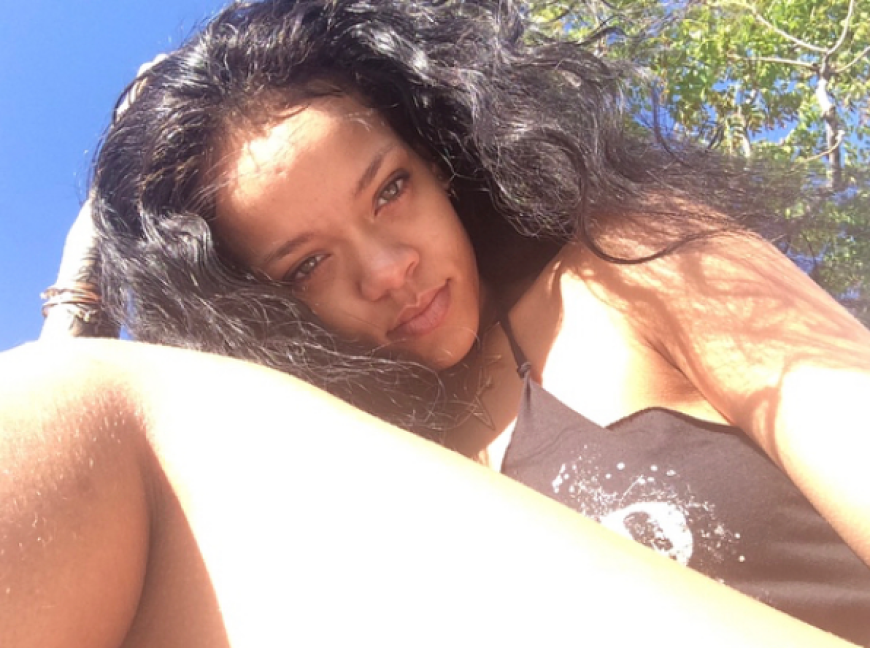 Detail-Shot! Rihanna zeigt uns ihre unrasierten Unterschenkel.