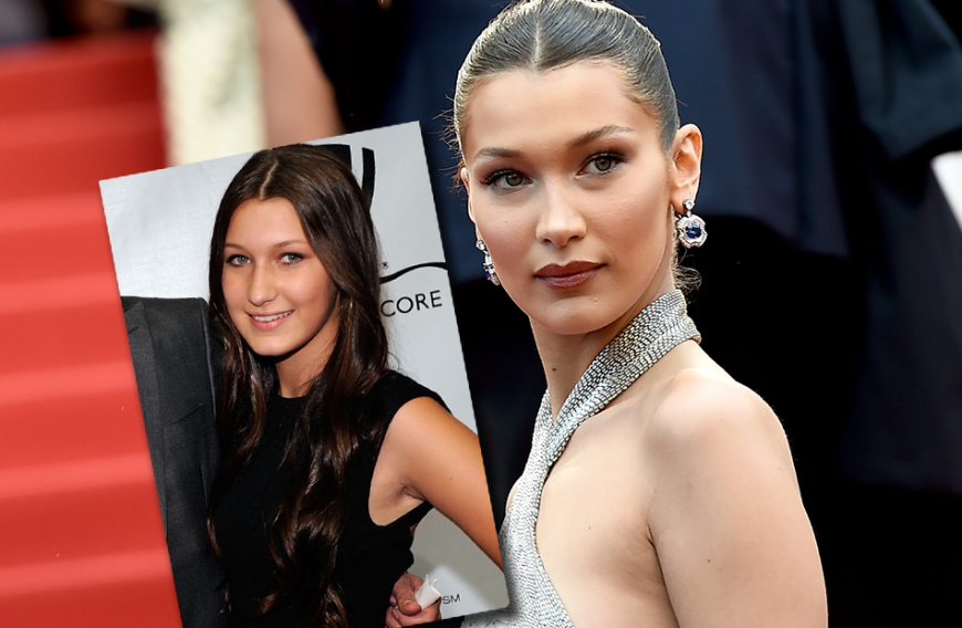 Ernsthaft? Bella Hadid streitet Beauty-OP ab!