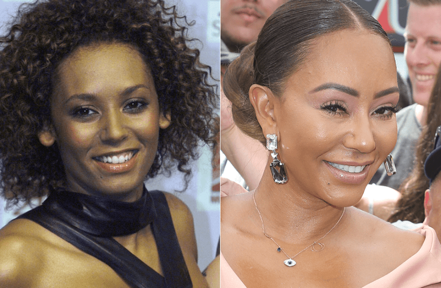 Ein bisschen Botox, eine kleine Lidstraffung? Ex-Spice-Girl Mel B sah in jungen Jahren noch deutlich anders aus.