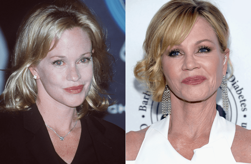 Schauspielerin Melanie Griffith ist seit 1998 Dauergast beim Beauty-Doc. Aber schön geht anders.