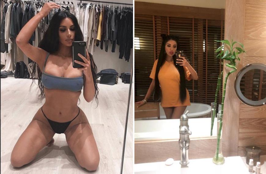 Kim Kardashian ist für ihre Looks weltweit berühmt. Und Jennifer eifert ihr nach, auch wenn sie dafür ihre Gesundheit aufs Spiel setzt.