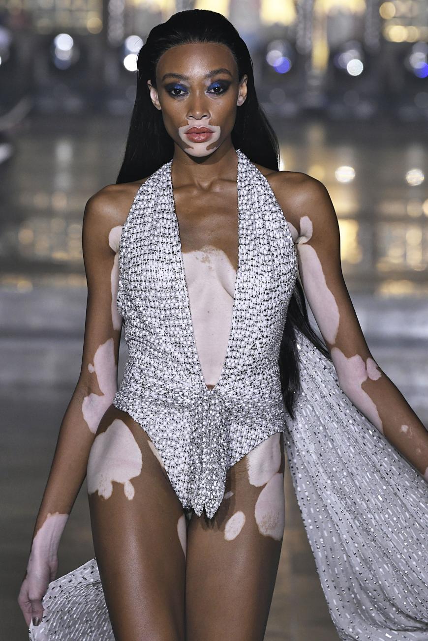 Winnie Harlow (24): Mehr Meer
Von Magenknurren hält die Kanadierin nichts. „Ich esse sehr viel Gemüse und Fisch. Zwischendurch stille ich mit Obst den Hunger“, so Winnie. Ihre ultimative Übung für stahlharte Bauchmuskeln: Kick-Crunches. Beine im 90-Grad-Winkel anheben und Oberkörper nach hinten lehnen. Nun einen Ball oder ein anderes Gewicht von einer Hüfte zur anderen heben. Dreimal je 20 Sekunden!