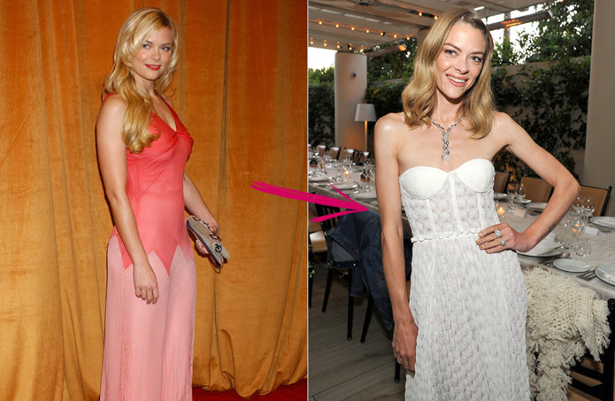 Jaime King (51 Kilo bei 1,74 Meter): Der „Hart of Dixie“-Star war in den Neunzigern süchtig nach dem Heroin-Chic. „Ich bin in Hollywood aufgewachsen. Mein ganzes Leben verspüre ich den Druck, den Körper einer 14-Jährigen haben zu müssen“, gibt das Ex-Model zu. „Ich esse nur noch Kleinkind-Portionen!“ Eine langjährige Mangelernährung, die man ihr ansieht: Da der Körper nicht mehr mit Fett isolieren kann, wächst überall Flaum.