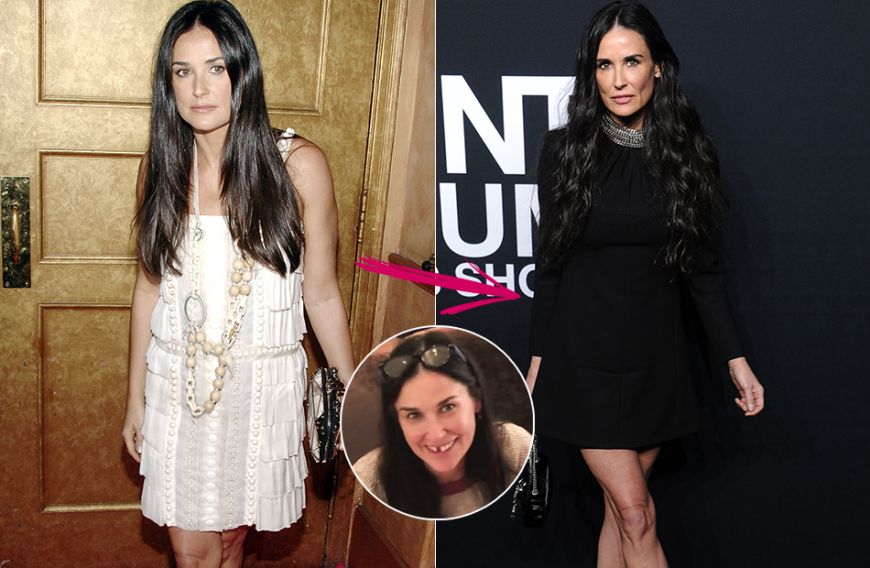 Demi Moore (56 Kilo bei 1,64 Meter): Zwei ihrer Frontzähne sind Demi plötzlich ausgefallen. Sie schob es auf den Stress, doch Ernährungsexperten wissen: Schuld ist vielmehr ihre ungesunde und unzureichende Ernährung. Immerhin hat Demi laut eigenen Aussagen jahrelang einem Idealgewicht hinterhergehungert!