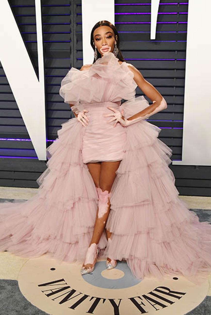 Wow! Winnie Harlow sah in ihrem Kleid einfach umwerfend aus.