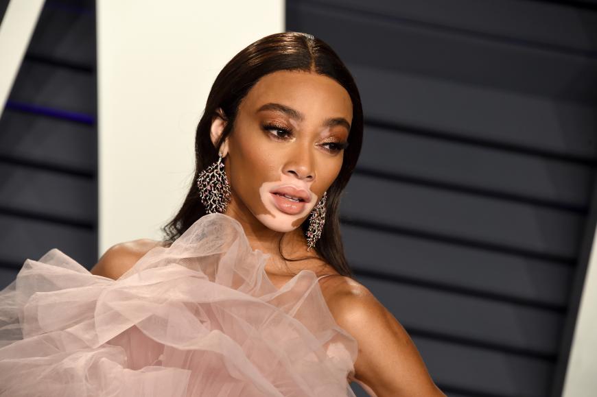 Gastjurorin in Folge 4: Winnie Harlow