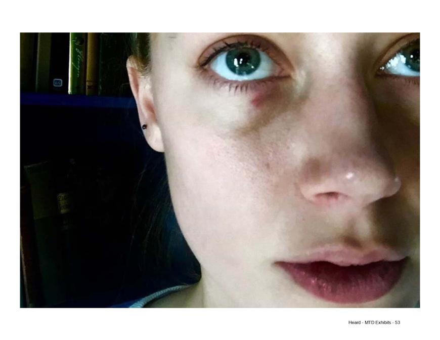 Depp bestreitet, Amber je angerührt zu haben. Die Wahrheit ist völlig unklar.