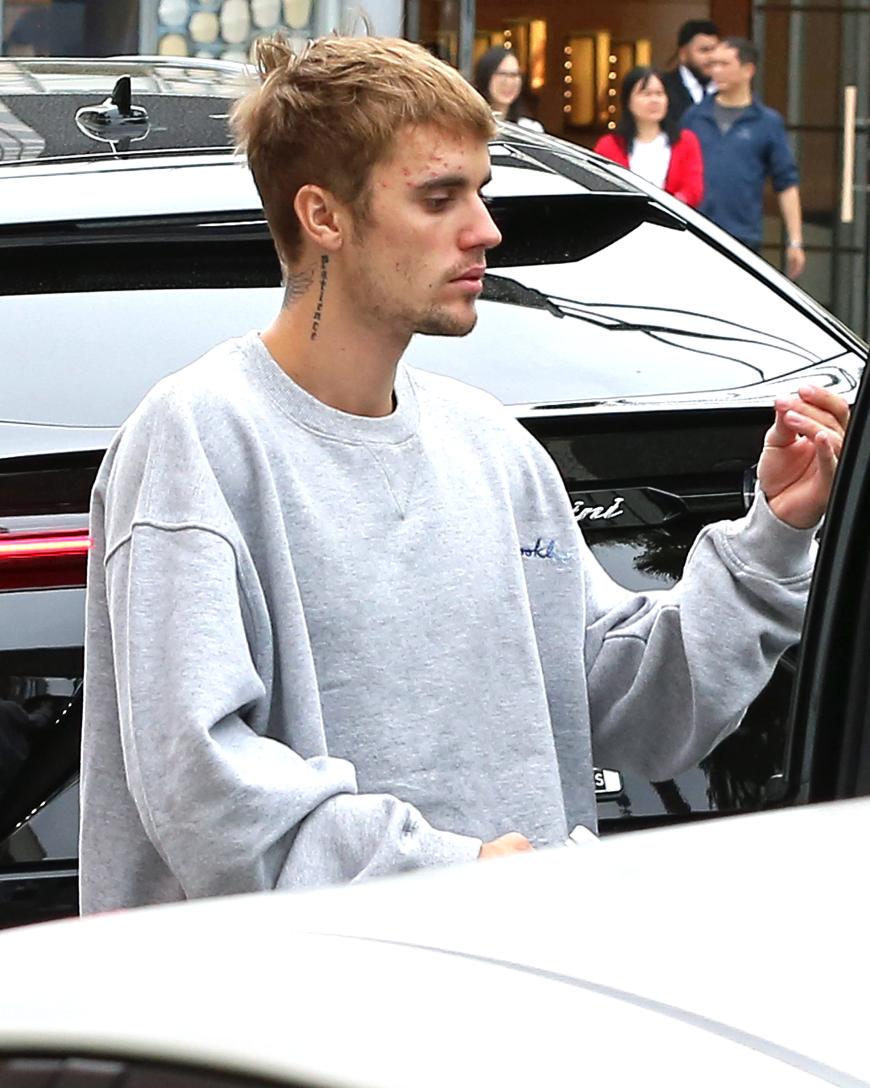 Justin Biebers Hautunreinheiten scheinen dem Sänger selbst zu schaffen zu machen. Er machte zuletzt einen unglücklichen Eindruck.