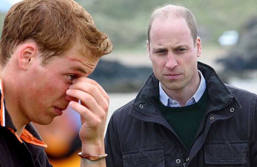 Prinz William bekommt eine Halbglatze.
