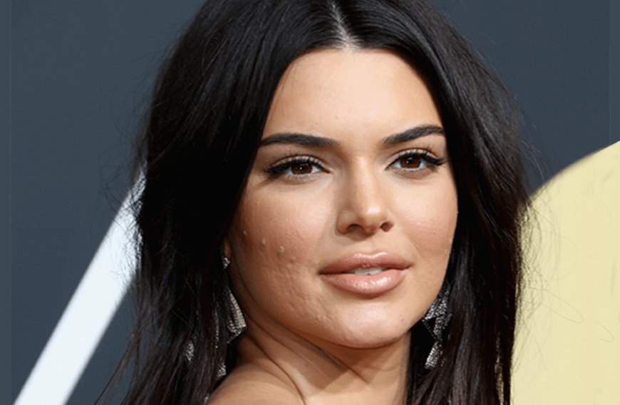 Kendall Jenner hat regelmäßig mit Unreinheiten zu kämpfen. Damit du in Zukunft die nervigen Pickel schnell wieder loswirst, haben wir ein tolles Naturprodukt entdeckt. 