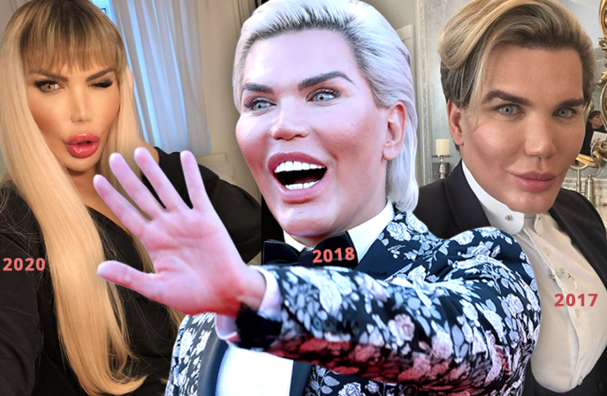 Als Real-Life-Ken wurde Rodrigo Alves berühmt und er führt wohl weltweit die Liste der OP-Rekorde an. Laut