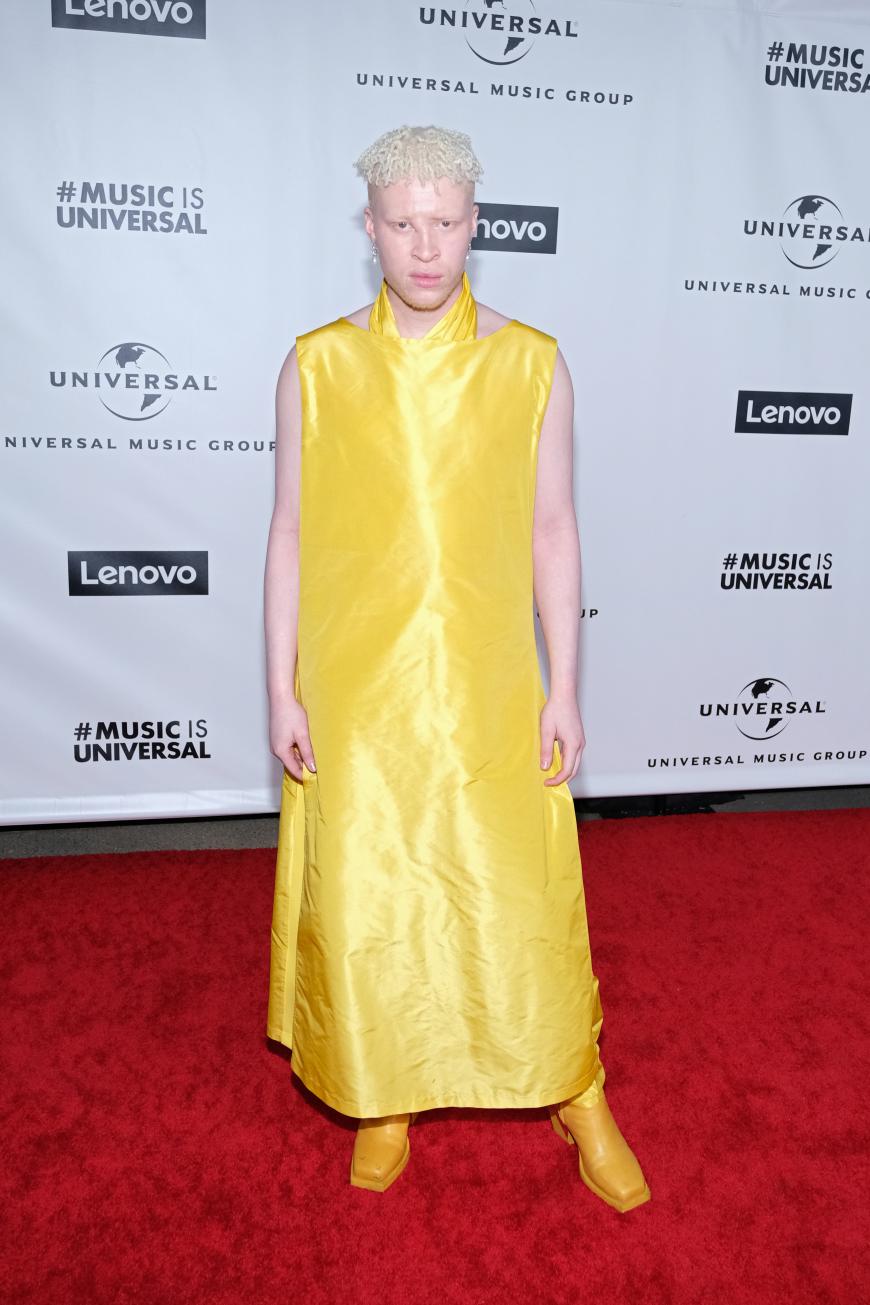 Das US-amerikanische Model Shaun Ross erlangte Bekanntheit als das erste professionelle Albino-Model. Bei den Grammys war Shauns gelbes extravagantes Outfit allerdings eher ein Flop ...