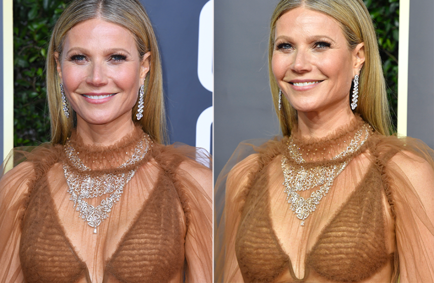 Hat sich Gwyneth Paltrow die Brüste vergrößern lassen?